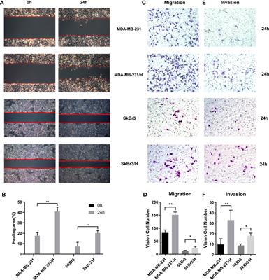 Variation of Long Non-Coding RNA And mRNA Profiles in Breast Cancer Cells With Influences of Adipocytes